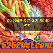 dự đoán kết quả xổ số mê