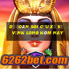 dự đoán soi cầu xổ số vĩnh long hôm nay