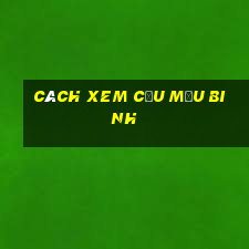 cách xem cầu Mậu Binh