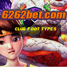 club foot types