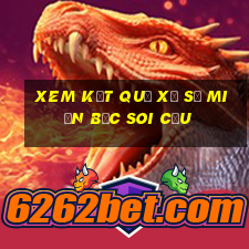 xem kết quả xổ số miền bắc soi cầu